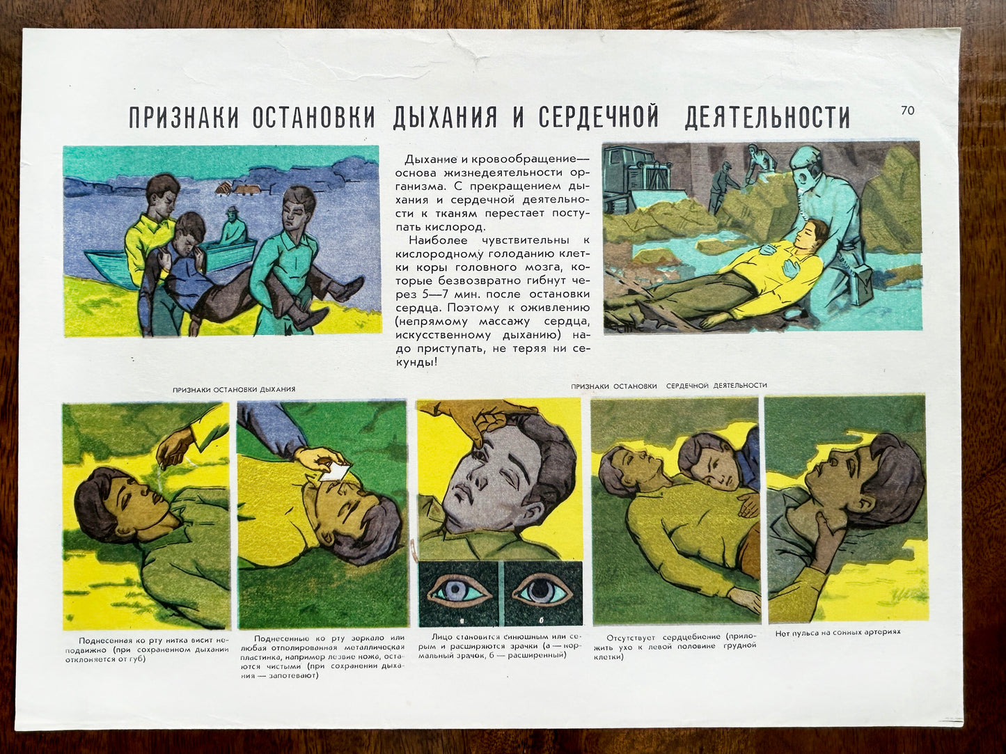 Original USSR vintage mid century first aid school chart: Signs of Respiratory and Cardiac Arrest illustrating warning signs and techniques 