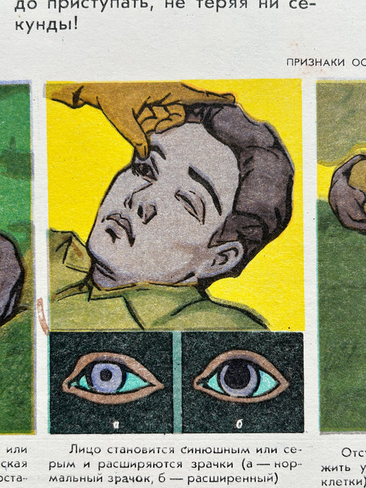 detail of vintage first aid USSR illustration about cardiac arrest showing dilated pupils