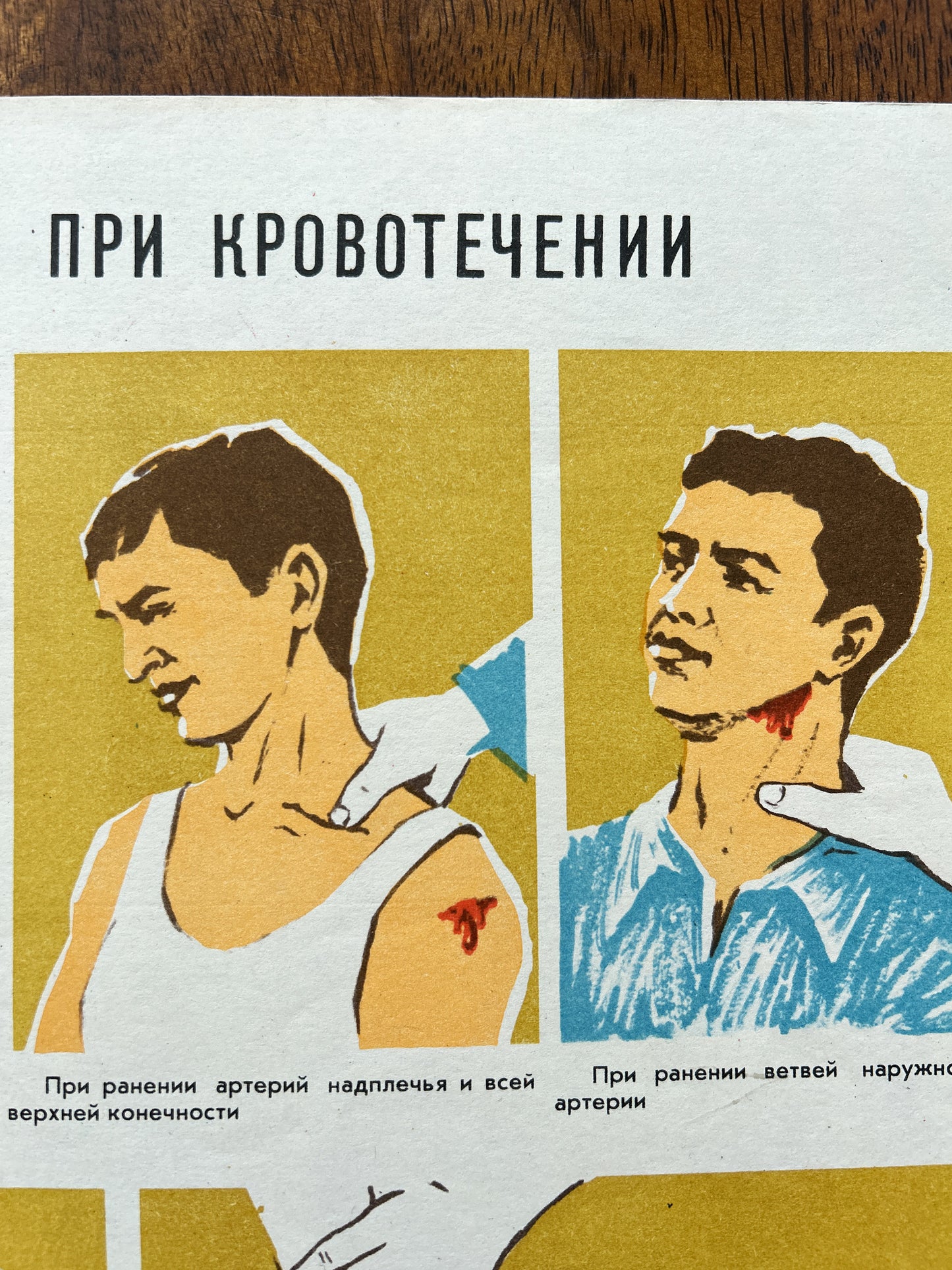 A vintage Soviet medical poster printed in Russian, featuring illustrated figures demonstrating neck artery compression techniques during haemorrhage. The poster is photographed lying on a dark wood surface.