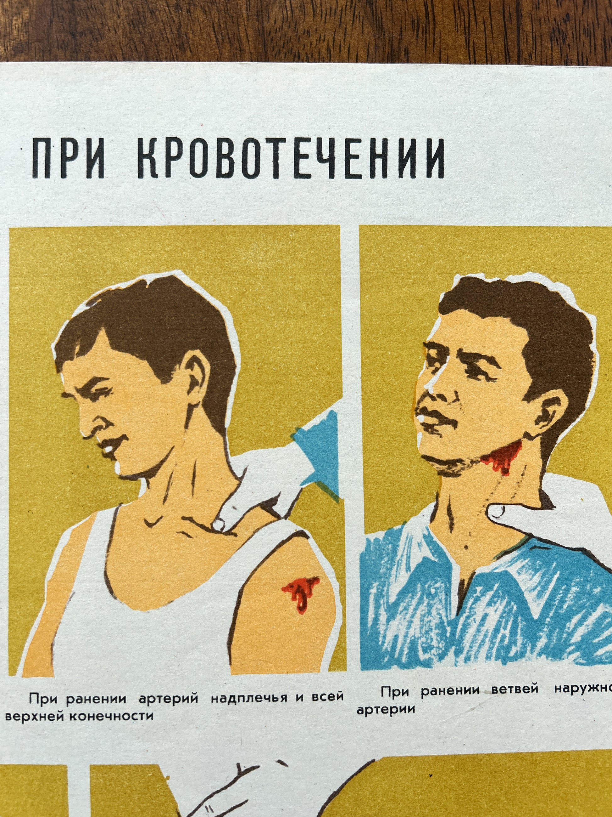 A vintage Soviet medical poster printed in Russian, featuring illustrated figures demonstrating neck artery compression techniques during haemorrhage. The poster is photographed lying on a dark wood surface.