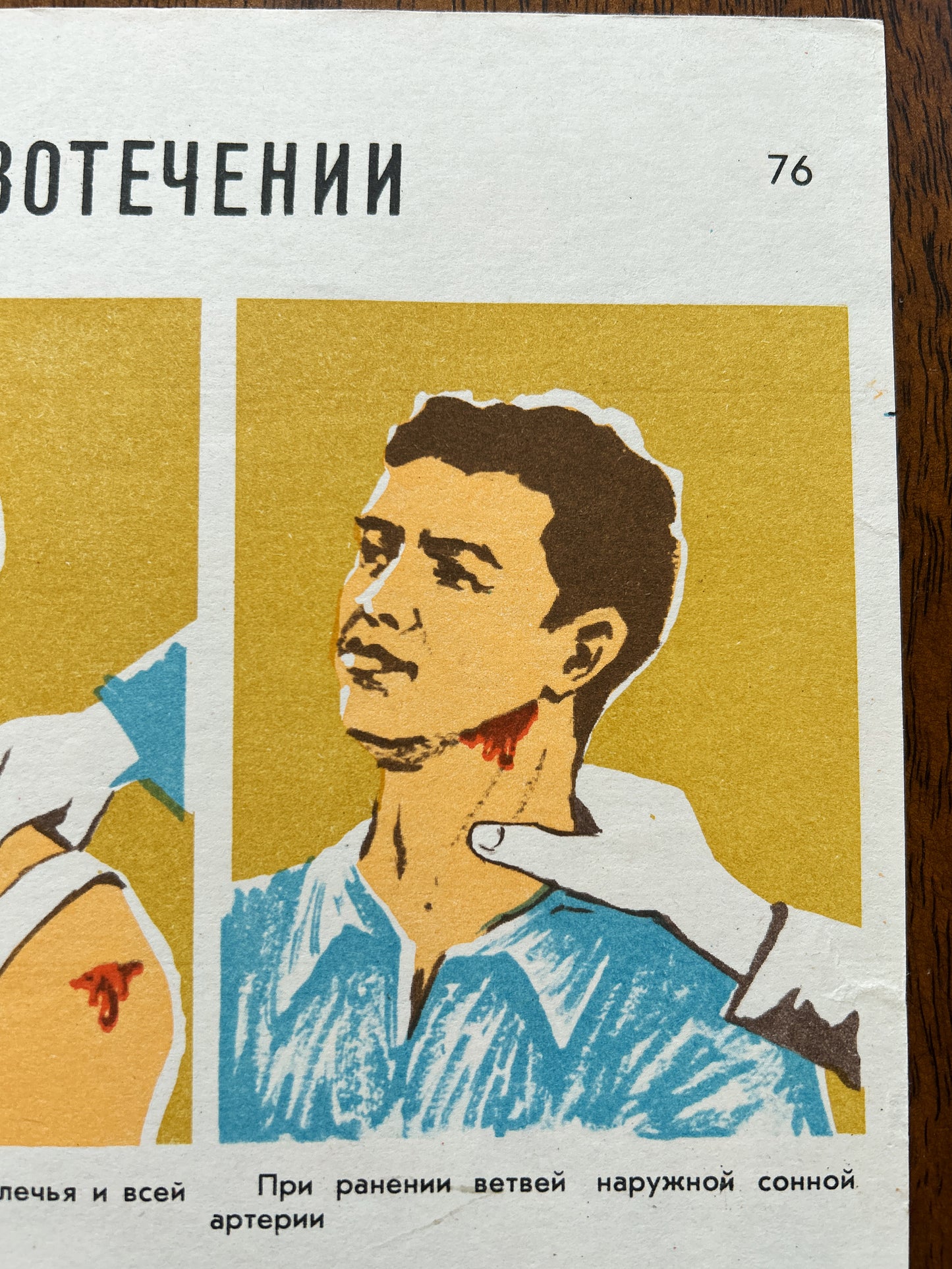 A Soviet vintage medical instruction sheet or poster showing a stylised illustration of a man with neck injury and a hand applying pressure, printed in yellow, blue, white, and red with Cyrillic text.