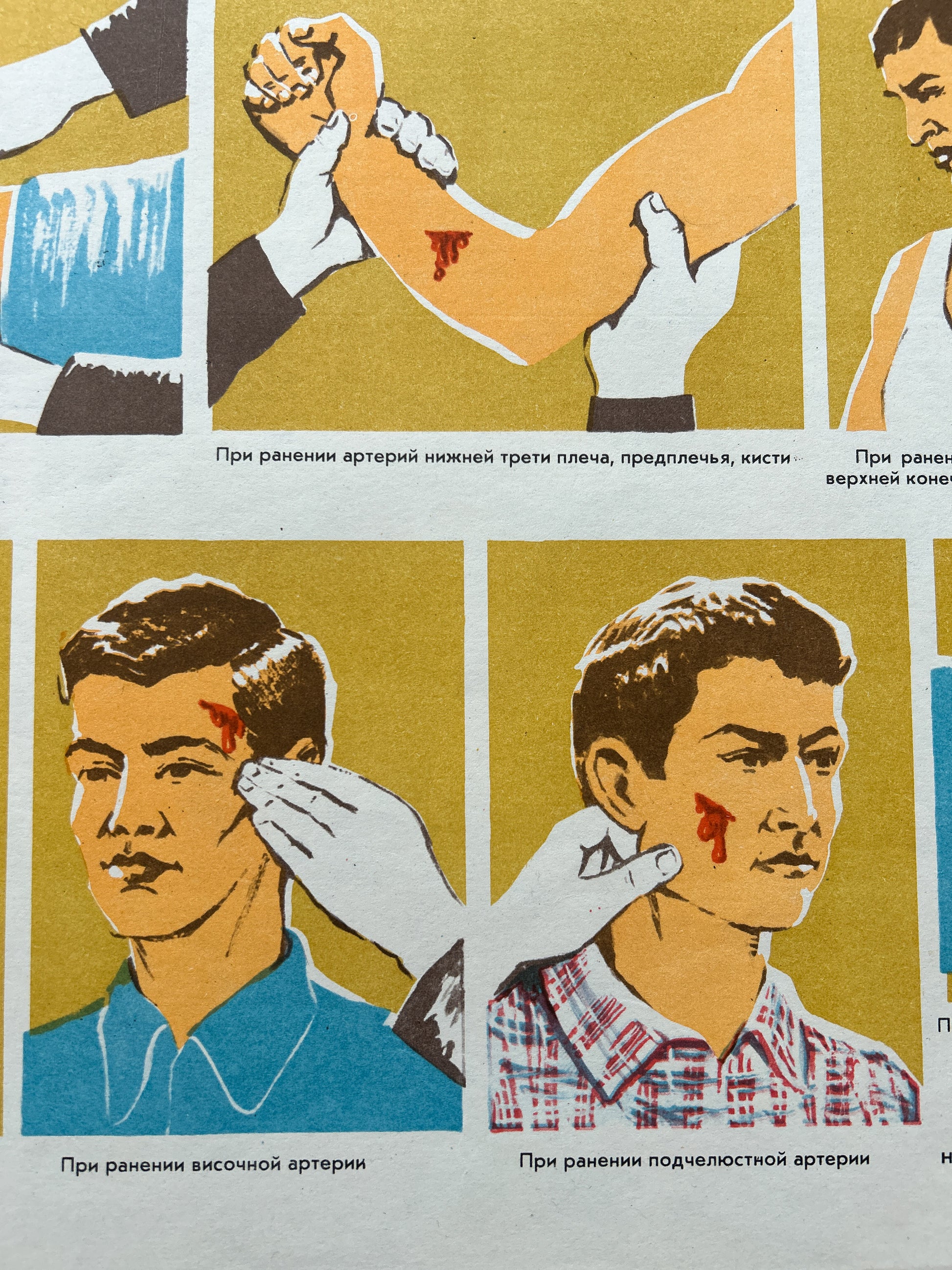 Soviet vintage instructional poster showing illustrated methods of arterial bleeding control, with Russian text and diagrams of hands holding arms and faces with simulated head wounds.