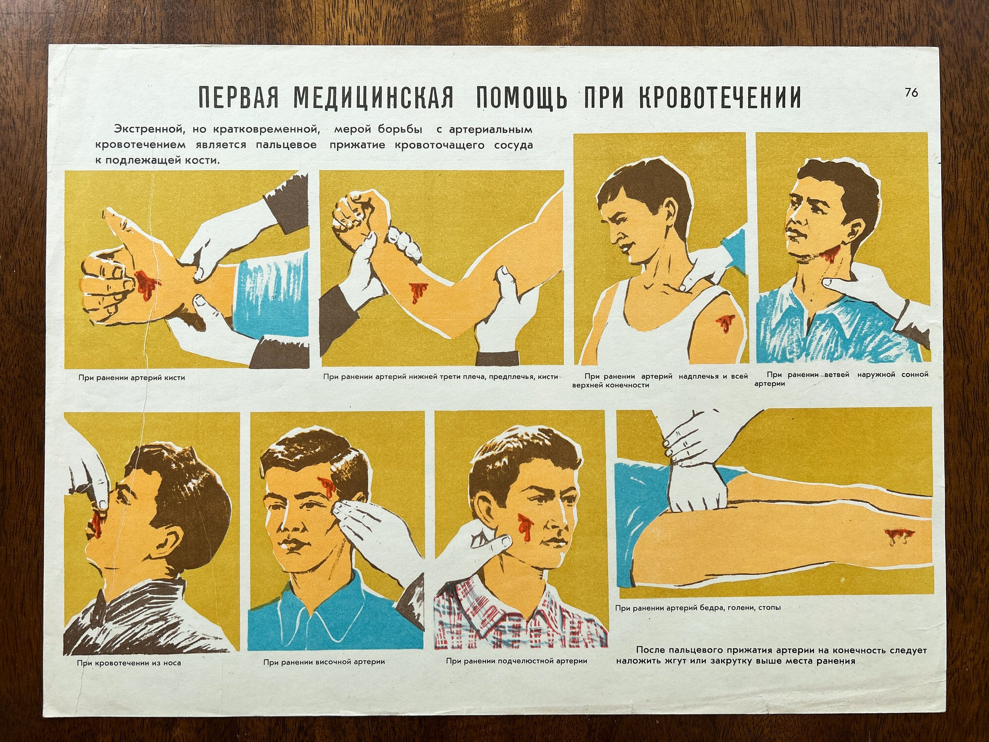 A USSR vintage medical instruction poster on the topic of first aid for bleeding, featuring illustrated panels demonstrating wound cleaning and haemostatic procedures with russian text.