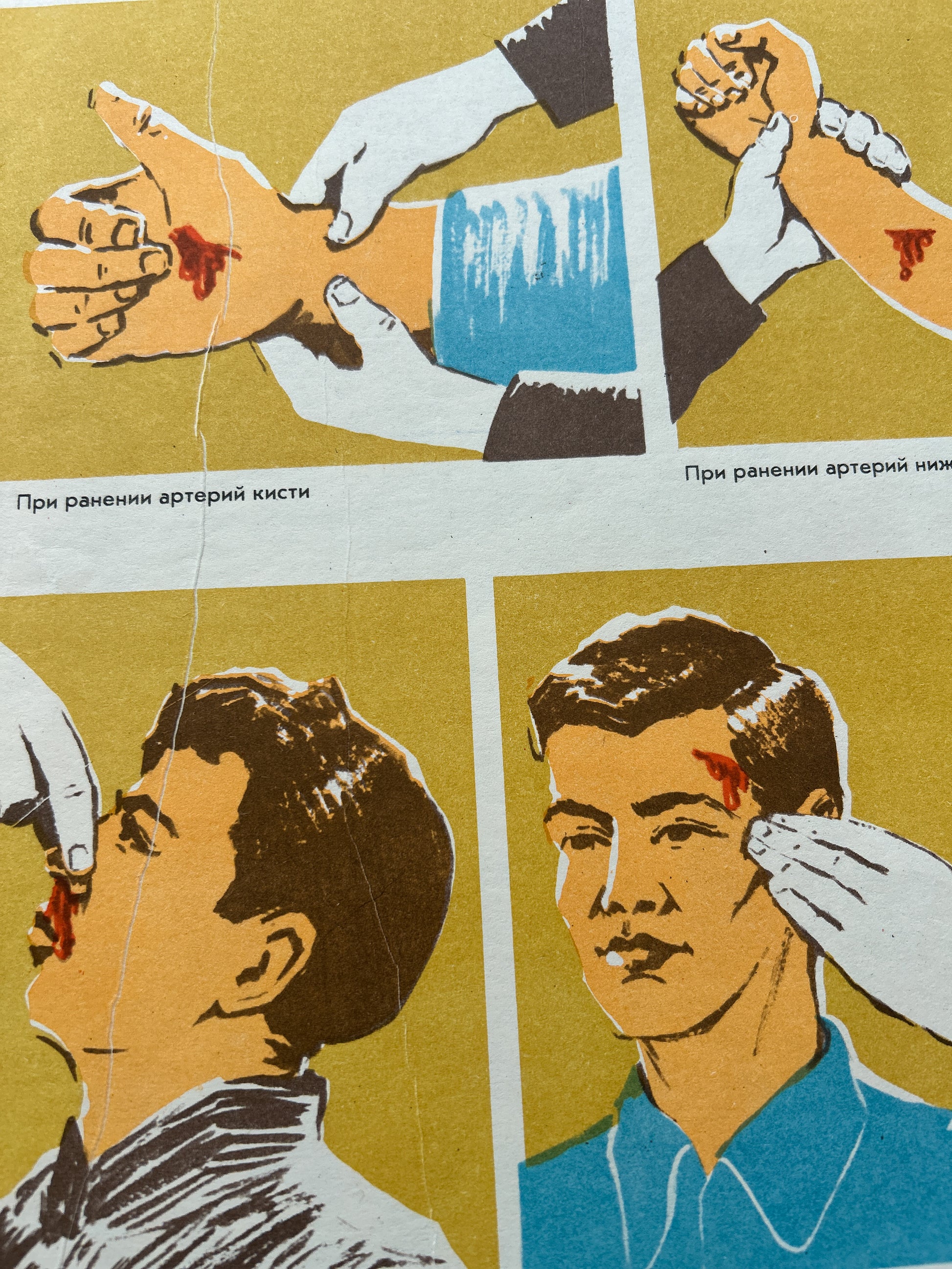 USSR vintage medical instruction poster in Russian showing how to treat facial and wrist artery gangrene wounds, featuring illustrated hands and faces with red blood details on a mustard yellow background.
