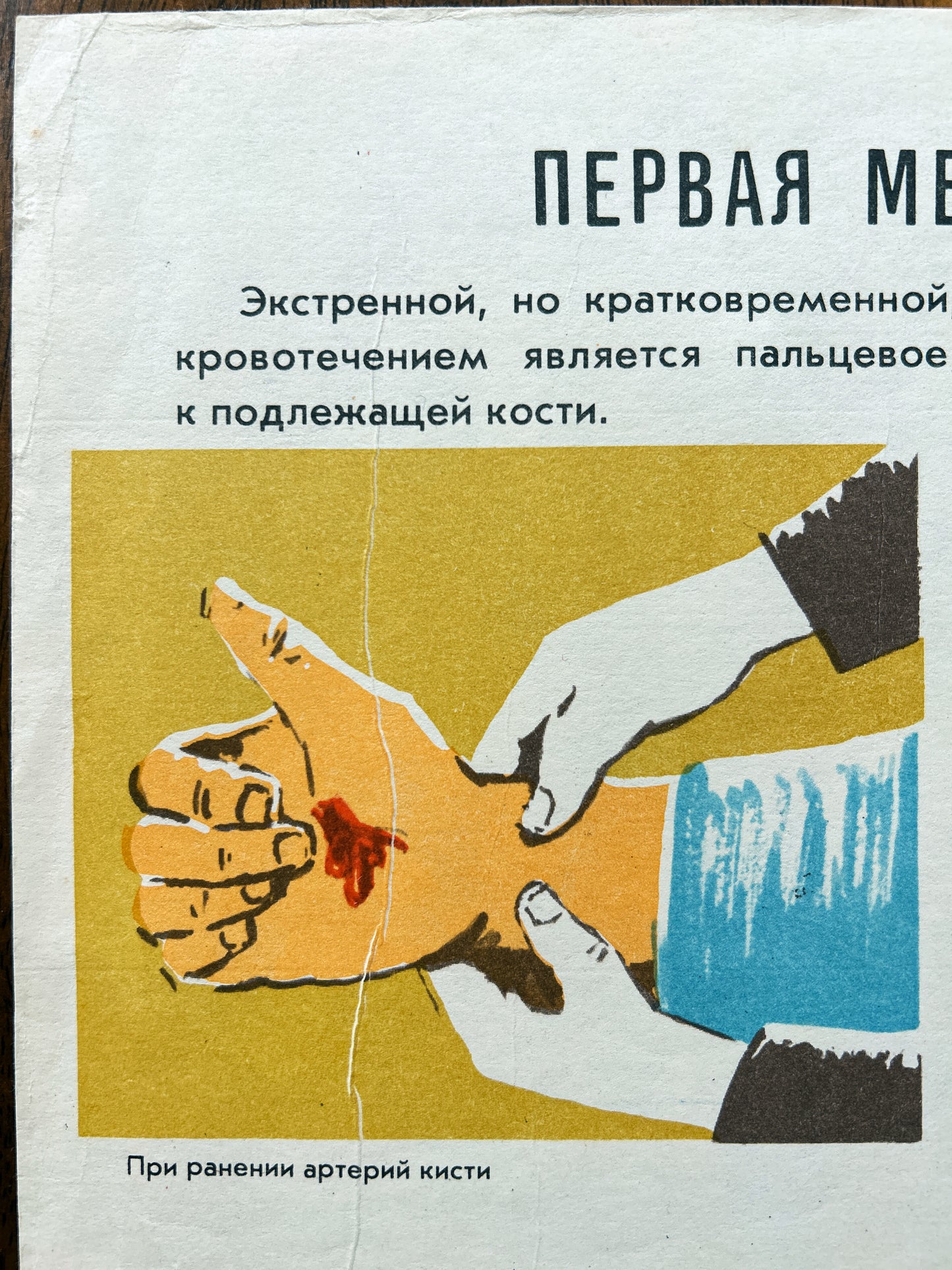 USSR vintage first aid instruction poster in russian showing how to apply pressure to a cut finger, with Cyrillic text and an illustration of gloved hands holding a hand over a red wound on a yellow background.