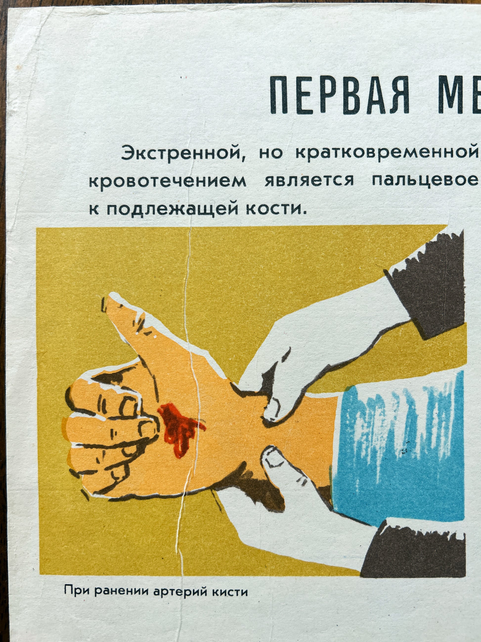 USSR vintage first aid instruction poster in russian showing how to apply pressure to a cut finger, with Cyrillic text and an illustration of gloved hands holding a hand over a red wound on a yellow background.