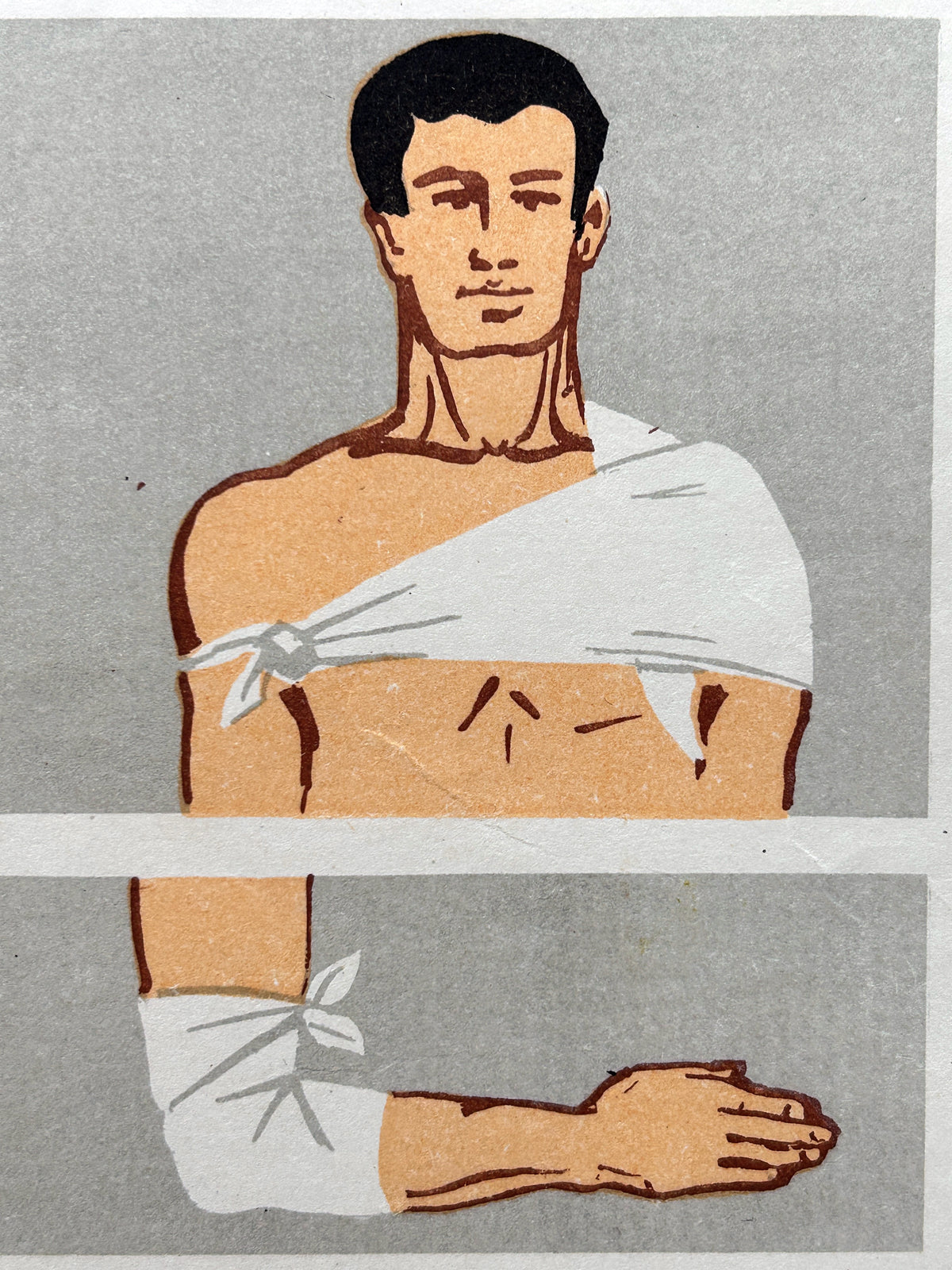 Close-up of a mid-century USSR vintage poster showing how to dress wounds to the shoulder and elbow with bandages on a man.