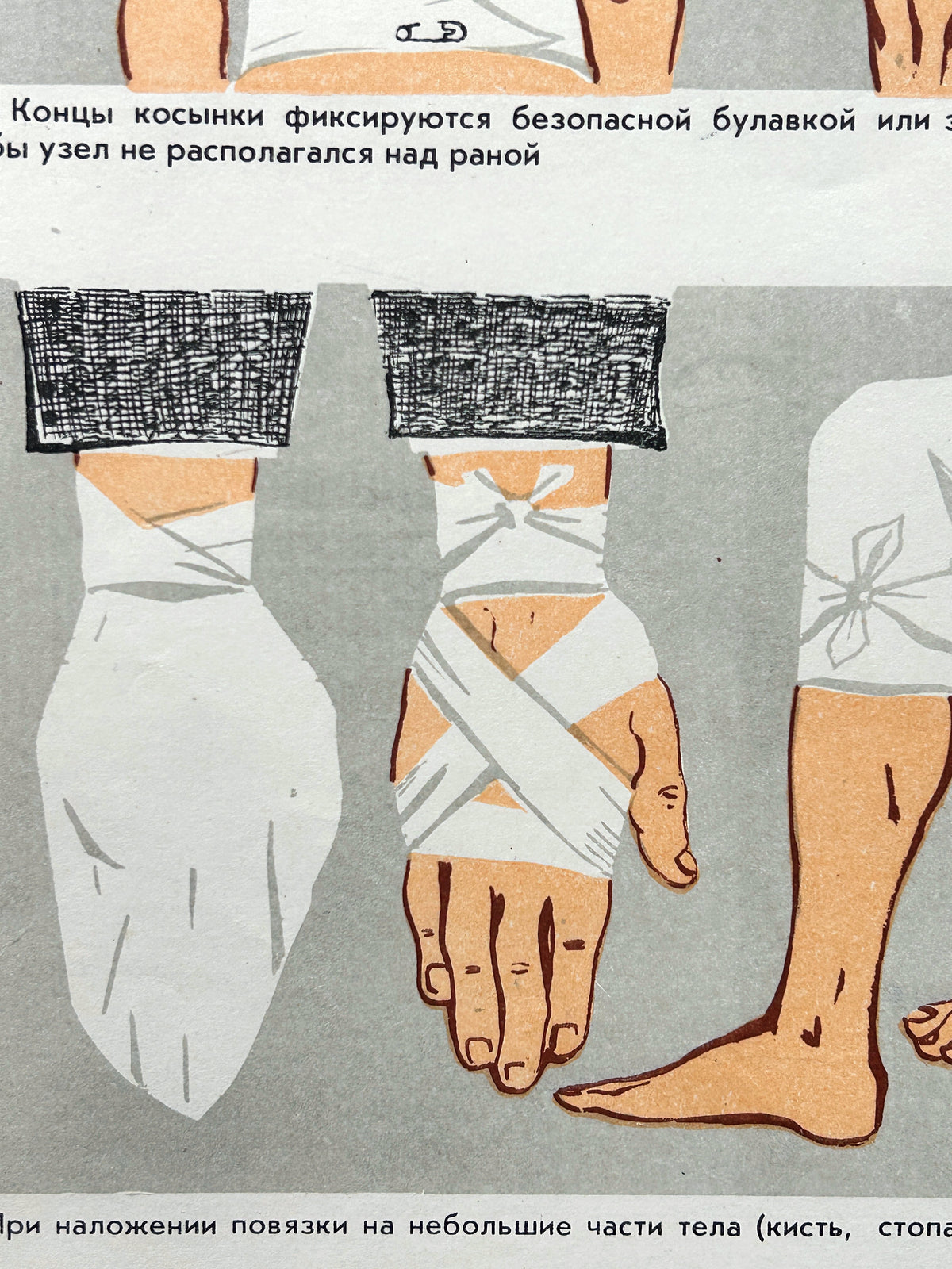 Close up of a USSR vintage medical poster illustrating how to dress wounds with bandages to hands and legs.