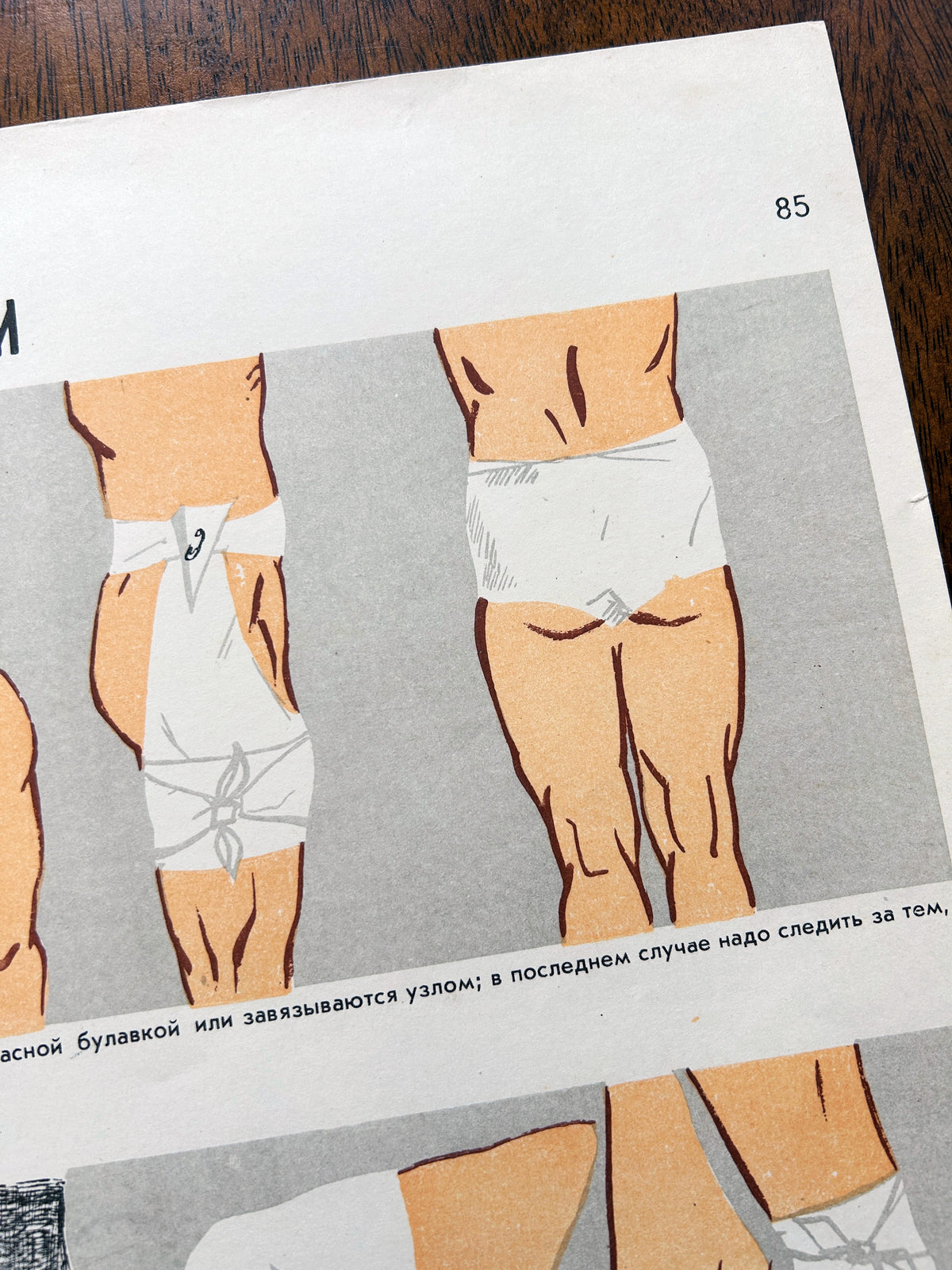 A close-up of a Soviet vintage mid-century medical poster showing illustrations of how to dress wounds on the lower body (butt and thigh) in Russian.