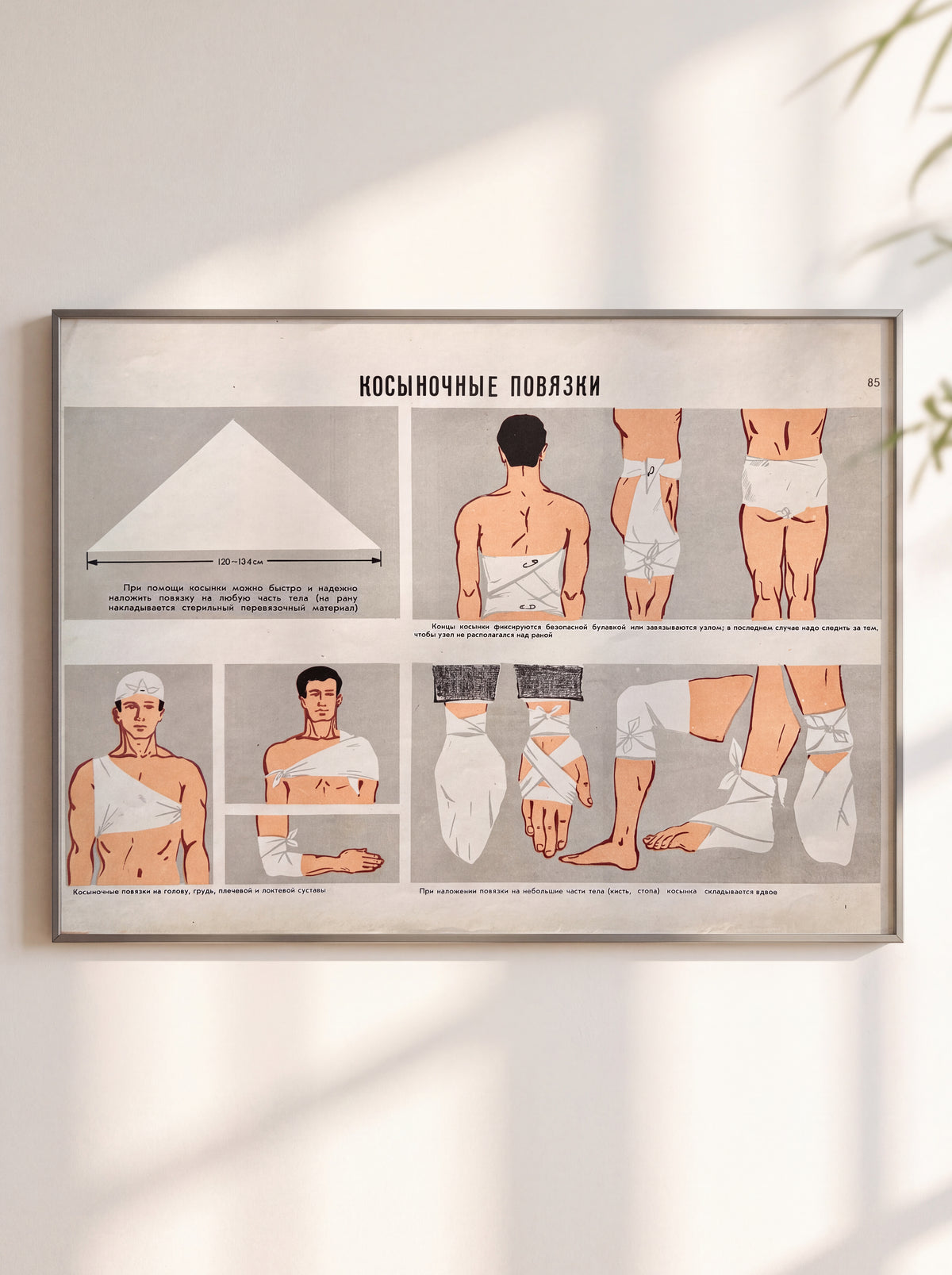 A framed mid-century USSR vintage instructional medical poster in Russian that teaches how to use a triangular bandage (a cravat bandage) to dress injuries on different parts of the body.
